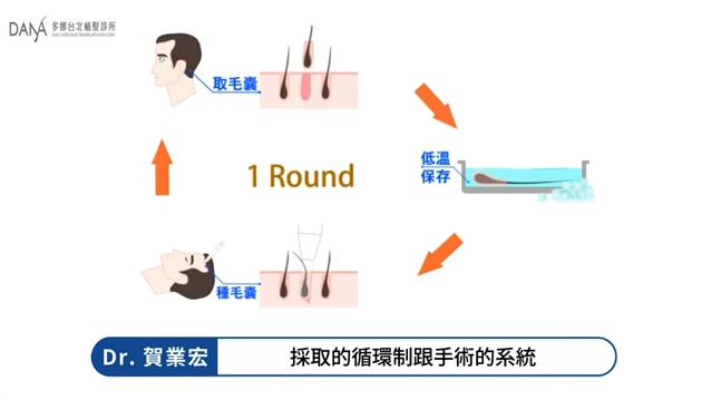 多娜台北植髮診所採取循環制手術系統