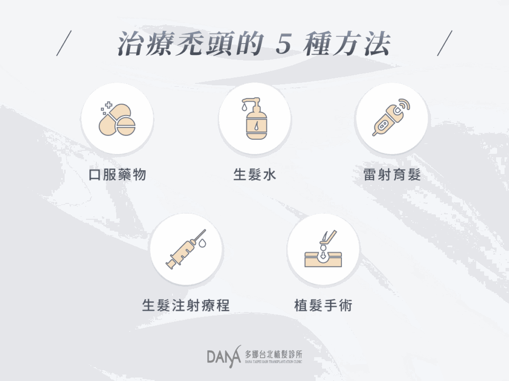 治療禿頭的 5 種方法