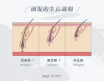 禿頭怎麼辦？為什麼會禿頭？禿頭原 …
