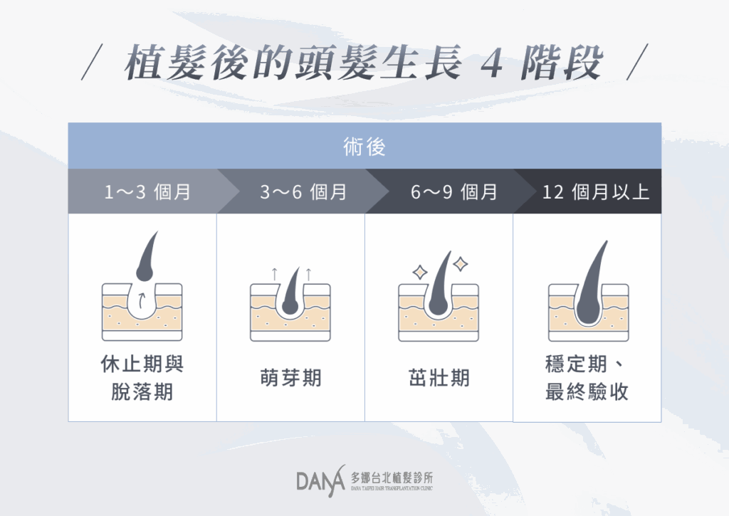 執法後的頭髮生長 4 階段