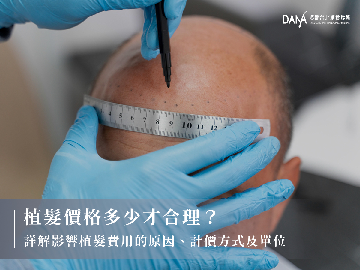 植髮價格多少才合理？詳解影響植髮費用的原因、計價方式及單位
