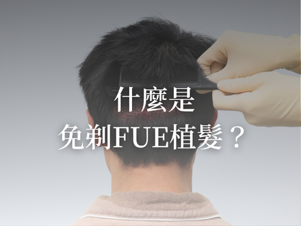醫師專欄文章：甚麼是免剃FUE？